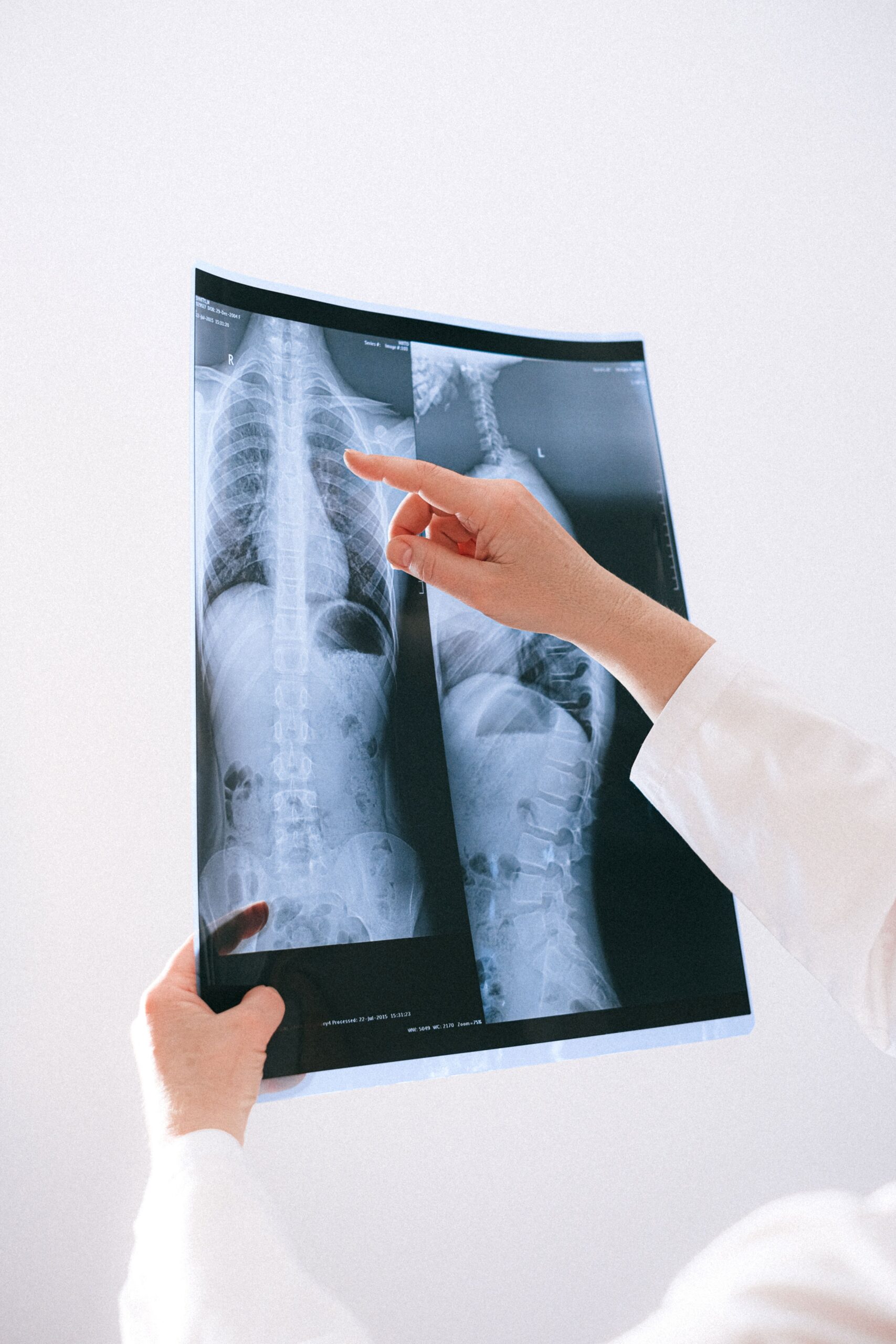 Microscopic Solutions Lead to Great Advancements in Lung Cancer Treatment 